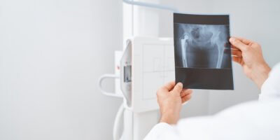 Cuatro hospitales recibirán nuevos equipos portátiles de rayos X en BCS