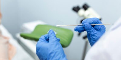 Agosto es el mes de la sensibilización del cáncer Cervicouterino; conoce cómo prevenirlo
